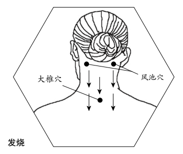 风寒感冒刮痧刮示意图图片